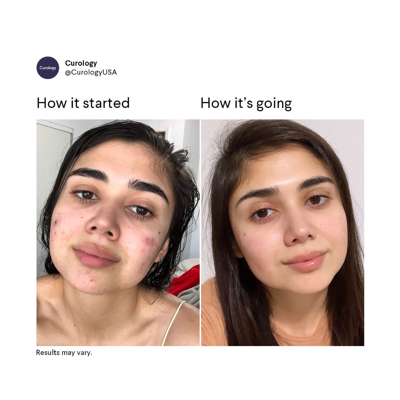 comparison comparison ad template — Curology