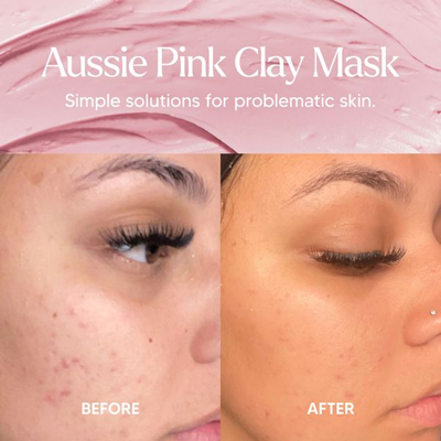 differentiation comparison ad template — Alya Skin Australia