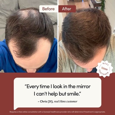 rating testimonial ad template — Hims