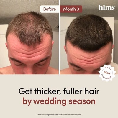 alternative comparison ad template — Hims