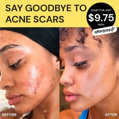 competitor comparison ad template — Gleamin